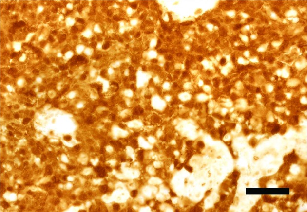 Papilloma in vitro